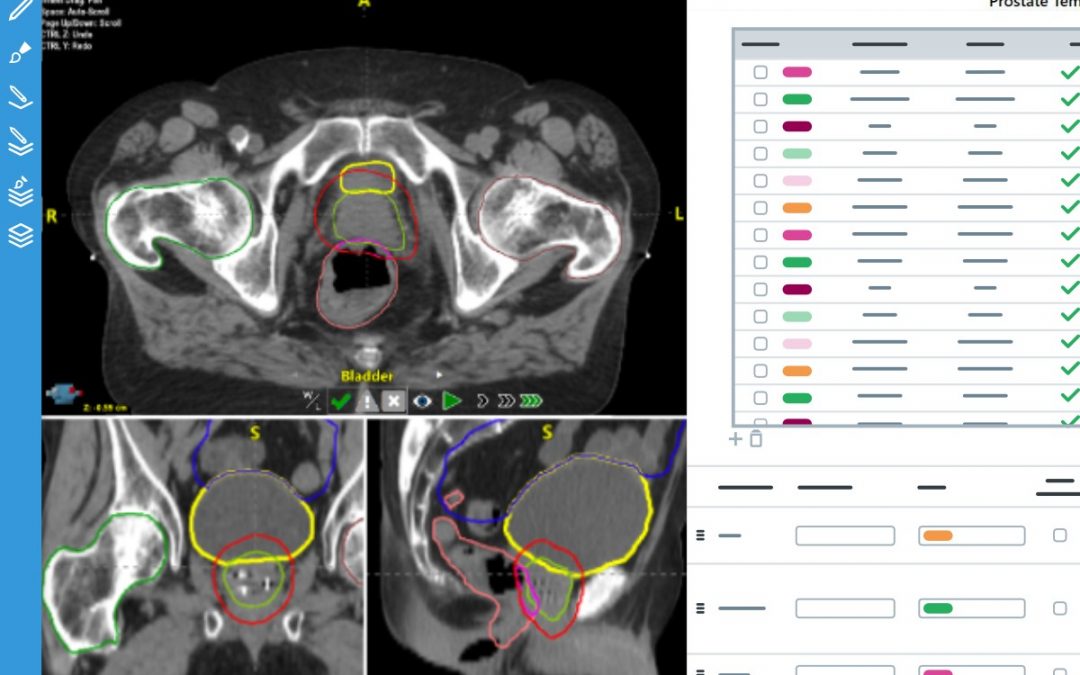 Logiciel de délinéation automatique